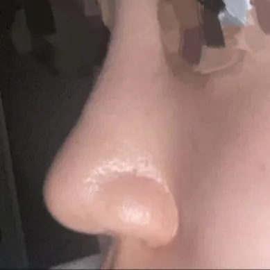 Tuyệt vời quá ㅠㅠㅠ Cảm ơn bác sĩ..