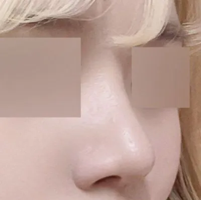 Mình sẽ không làm nếu không có niềm tin vào bác sĩ ㅋㅋ