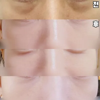 Mình hy vọng nó sẽ tốt hơn theo thời gian.