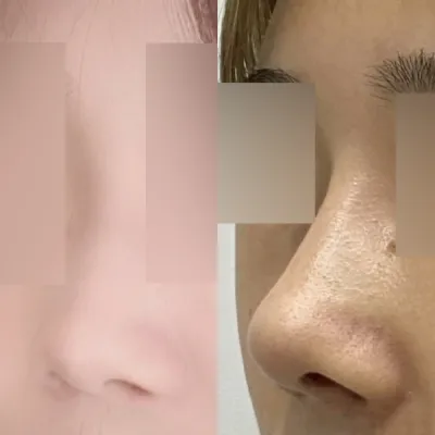 Mình đã tự tin hơn sau phẫu thuật