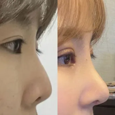 Mình đã phẫu thuật lại mũi với bác sĩ Seo và phẫu thuật lại mắt với bác sĩ Shim