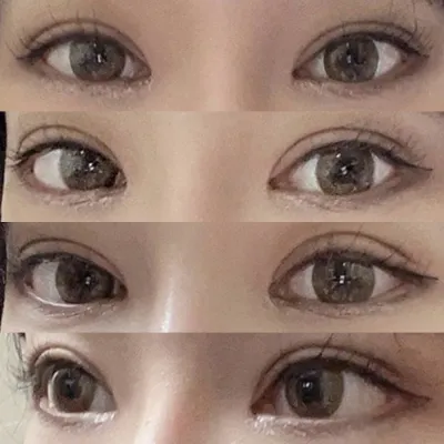 Mình đã sửa mắt một mí!