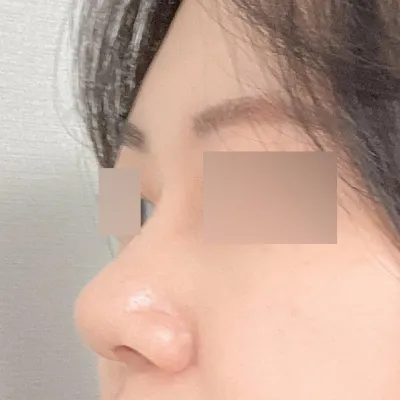 Đánh giá sau 3 tháng phẫu thuật