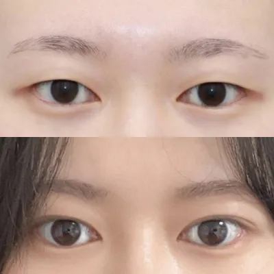 Đánh giá sau 3 tháng phẫu thuật