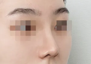 After