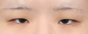 Before