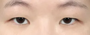 Before
