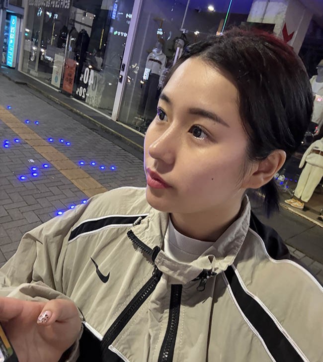 무보형물 자가늑 코수술 받았습니당!!