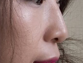 Mũi gồ ghề ㅋㅋ