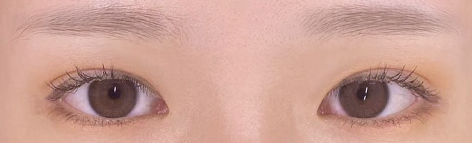 Cắt mí tự nhiên! Ưng ý hết sức luôn