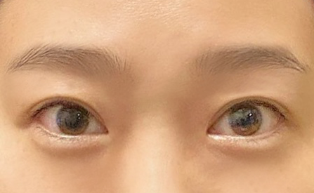 Nối mi tự nhiên