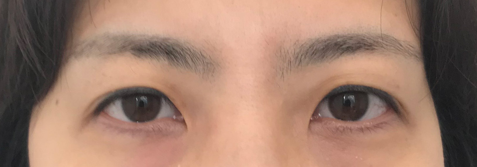 사람들이 이미지가 달라졌다며 병원이랑 원장님 누구냐고 자꾸 물어보네요 ㅎㅎ