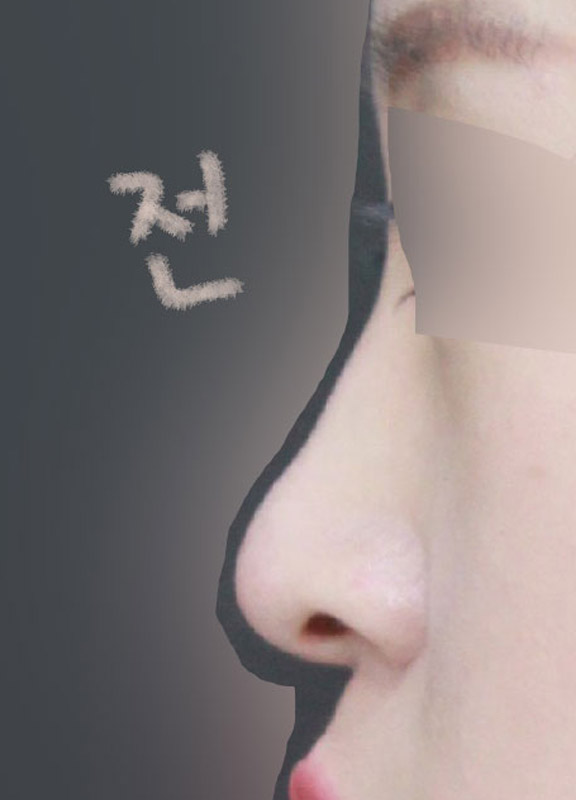 자연스럽게 수술 해주신 원장님 정말 감사해요!