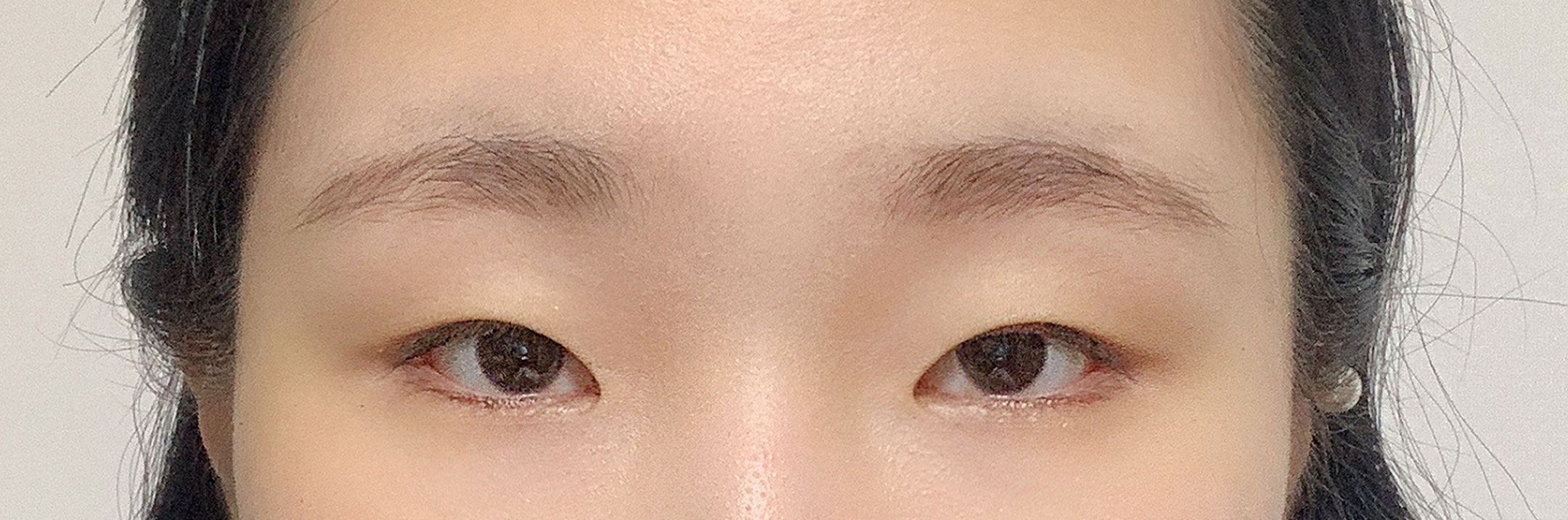 드디어 기다리고 기다리던 쌍수했습니당..