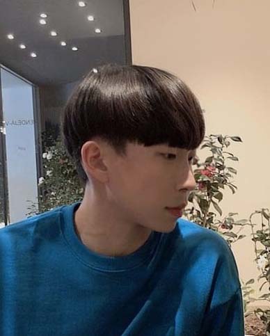 남자 광대, 사각턱 축소수술 후기 입니다