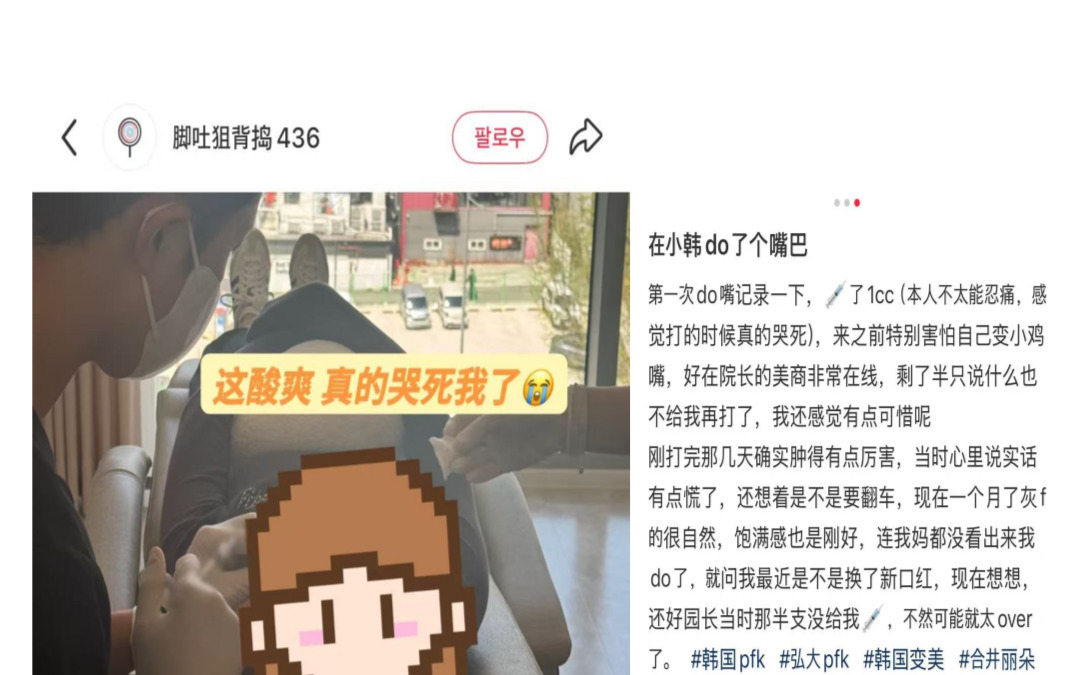 [J***고객님 입술필러후기]