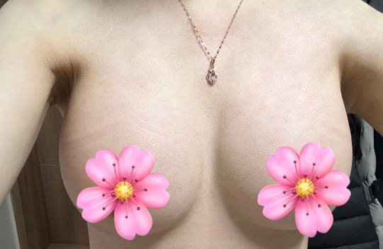 멜론 1달차 후기