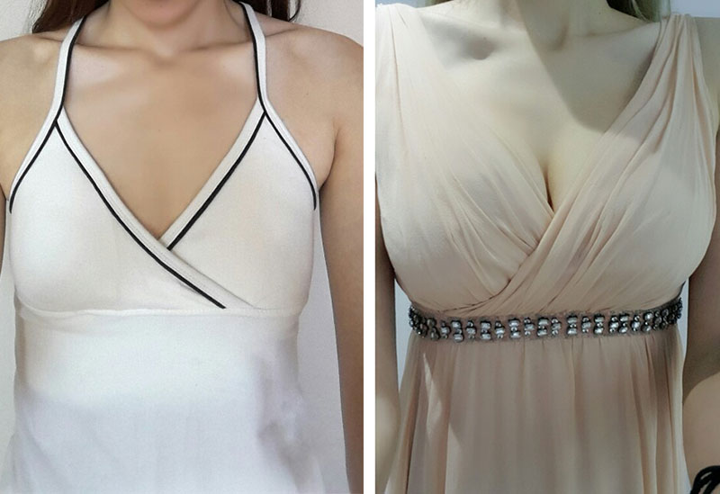 Đánh giá nâng ngực ạ ~