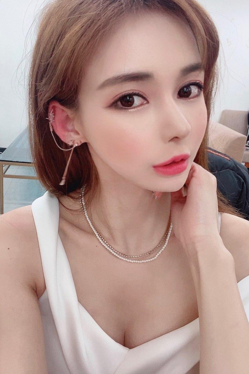 [Chất làm đầy môi] [Botox gian mày]