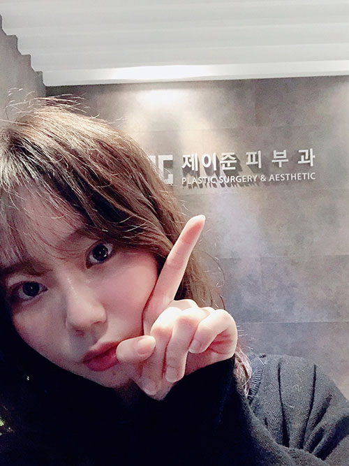 Mình đã tiêm tan mỡ