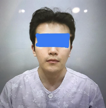 Gọt hàm vuông, thu nhỏ xương gò má, độn cằm, cắt bỏ vỏ xương, laser Venus, tiêm tan mỡ