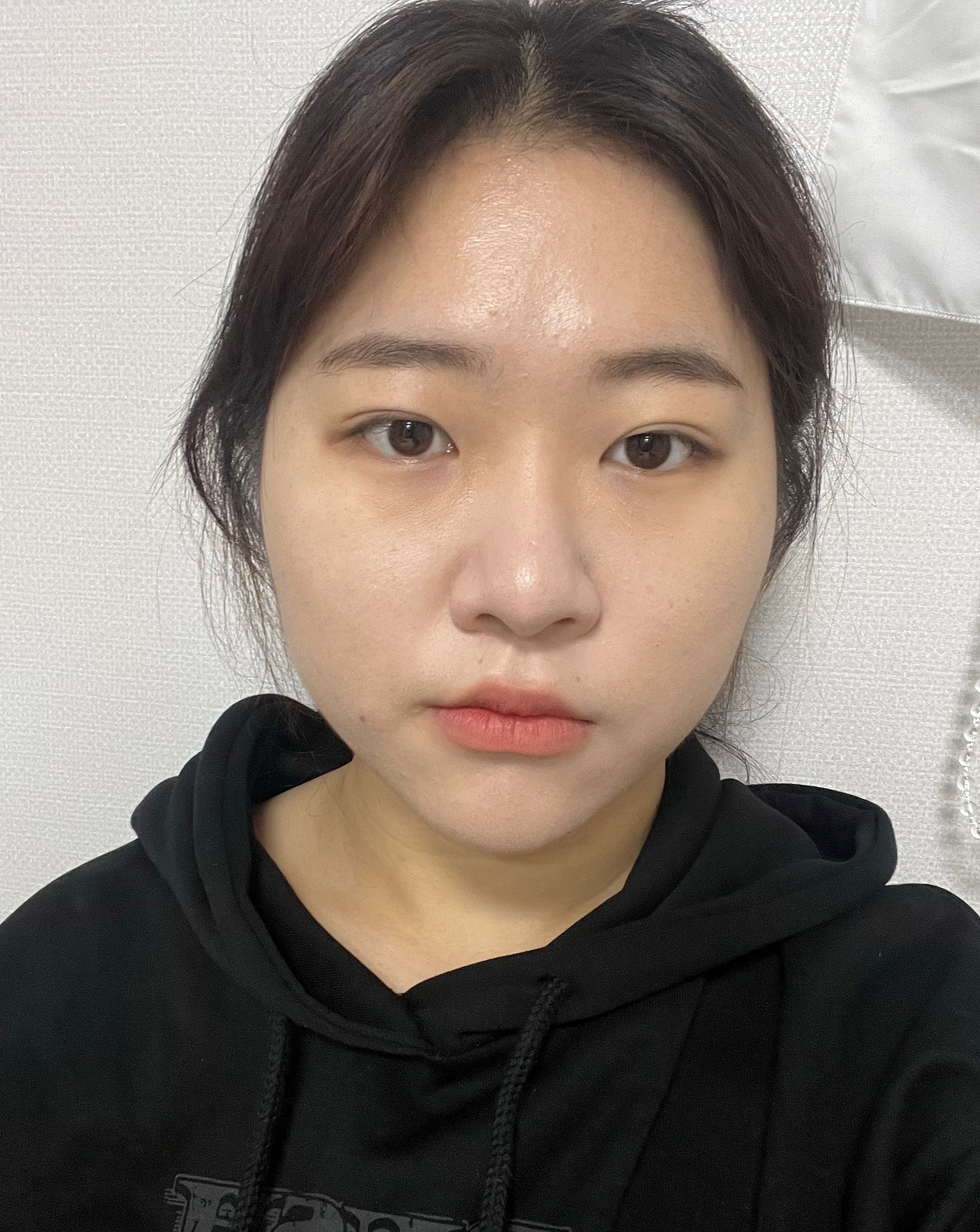 [Mắt] Cheli Jelly - Mở rộng góc mắt ngoài, mở rộng góc mắt dưới