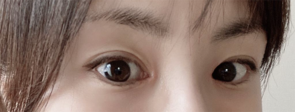 [Mắt] ㅈㅎㅊ - Mắt