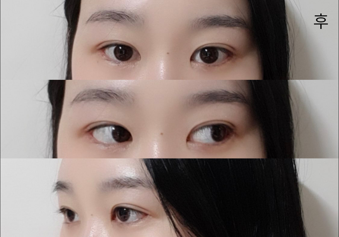 [Mắt] Gisop - Mắt