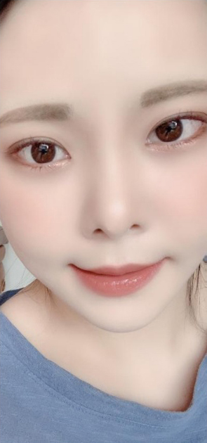 [Mắt] songi1938 - Mở rộng góc mắt ngoài, hạ góc mắt dưới