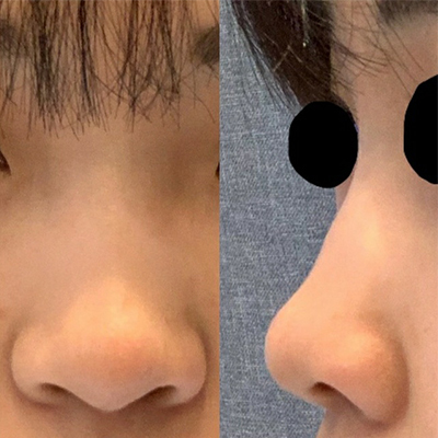 [Mũi] Kkong Kkong Gong - Mũi