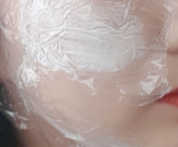 [Da] Hwangtotori - Ultherapy, Tiêm Chanel