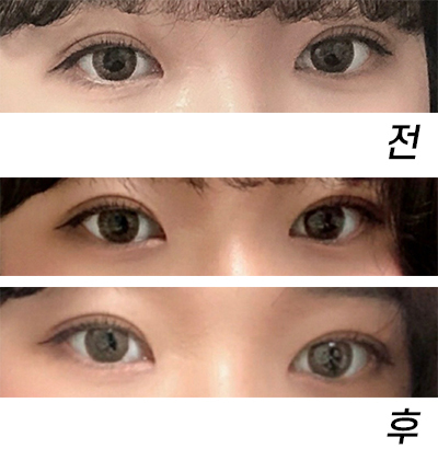 [Mắt] qhrehd - Mắt