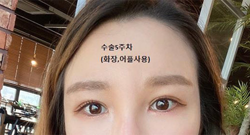 [Mắt] Naeuri Euri - Mắt