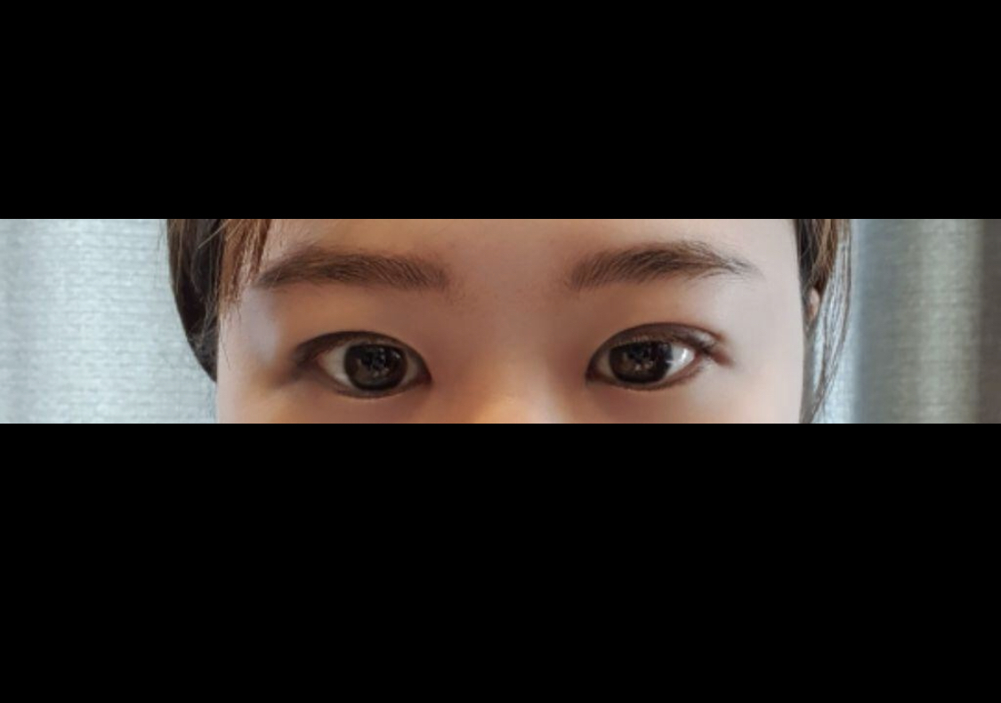 [Mắt] Jjiruring - Hạ góc mắt ngoài, mở rộng góc mắt trong