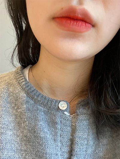 [Tiêm thẩm mỹ] zzieun - Botox hàm