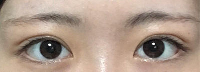 [Mắt] Kwon Dong-ha - Mắt