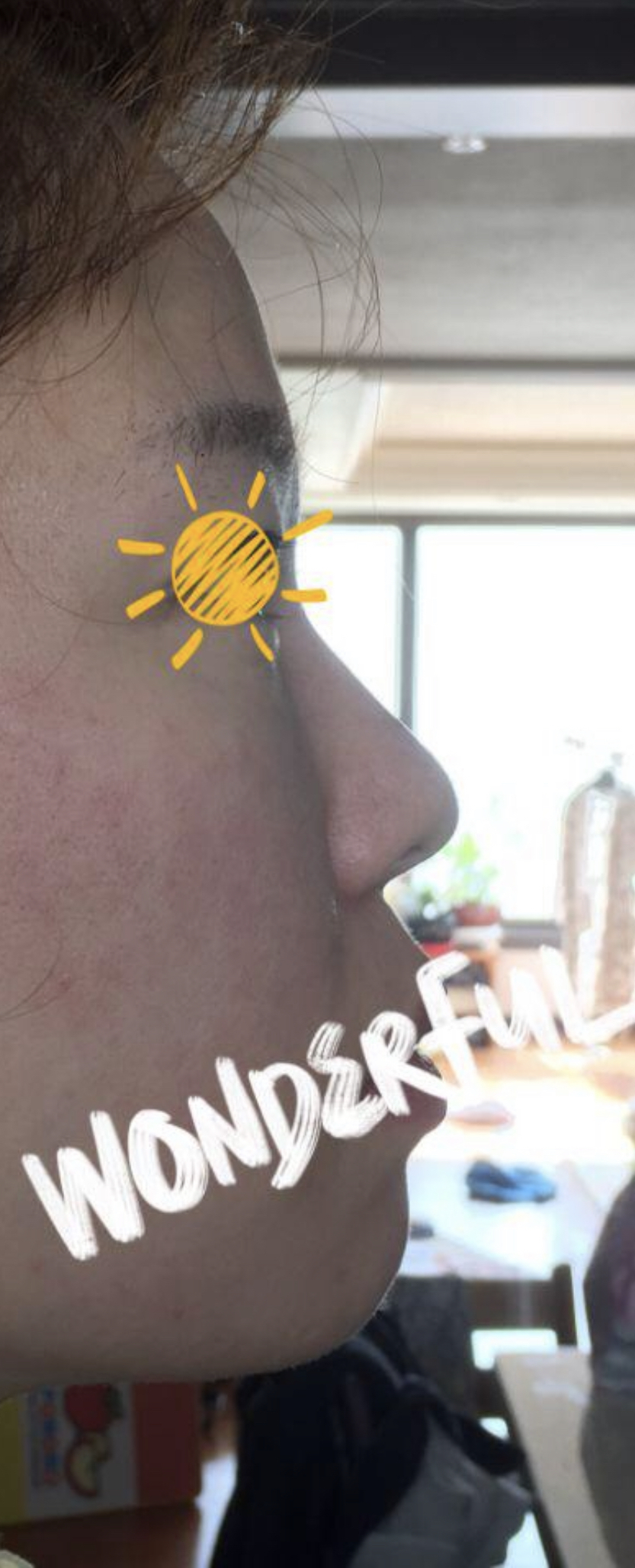 [Mũi] Shee288 - Sống mũi, Đầu mũi