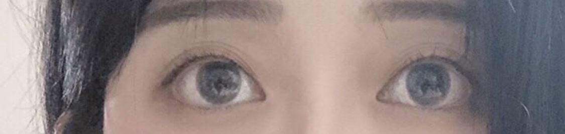 [Mắt] Hitwo - Chỉnh sửa mí mắt, nhấn mí