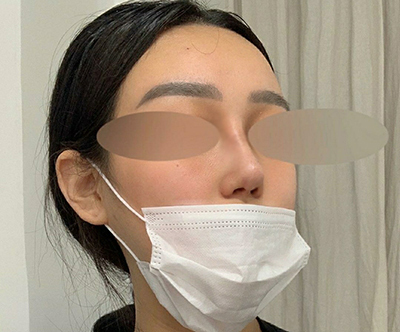 [Mũi] do_hee - Mũi