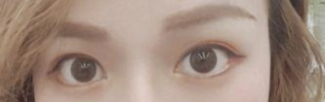 [Mắt] Làm theo ý muốn - Mở rộng góc mắt ngoài, hạ góc mắt