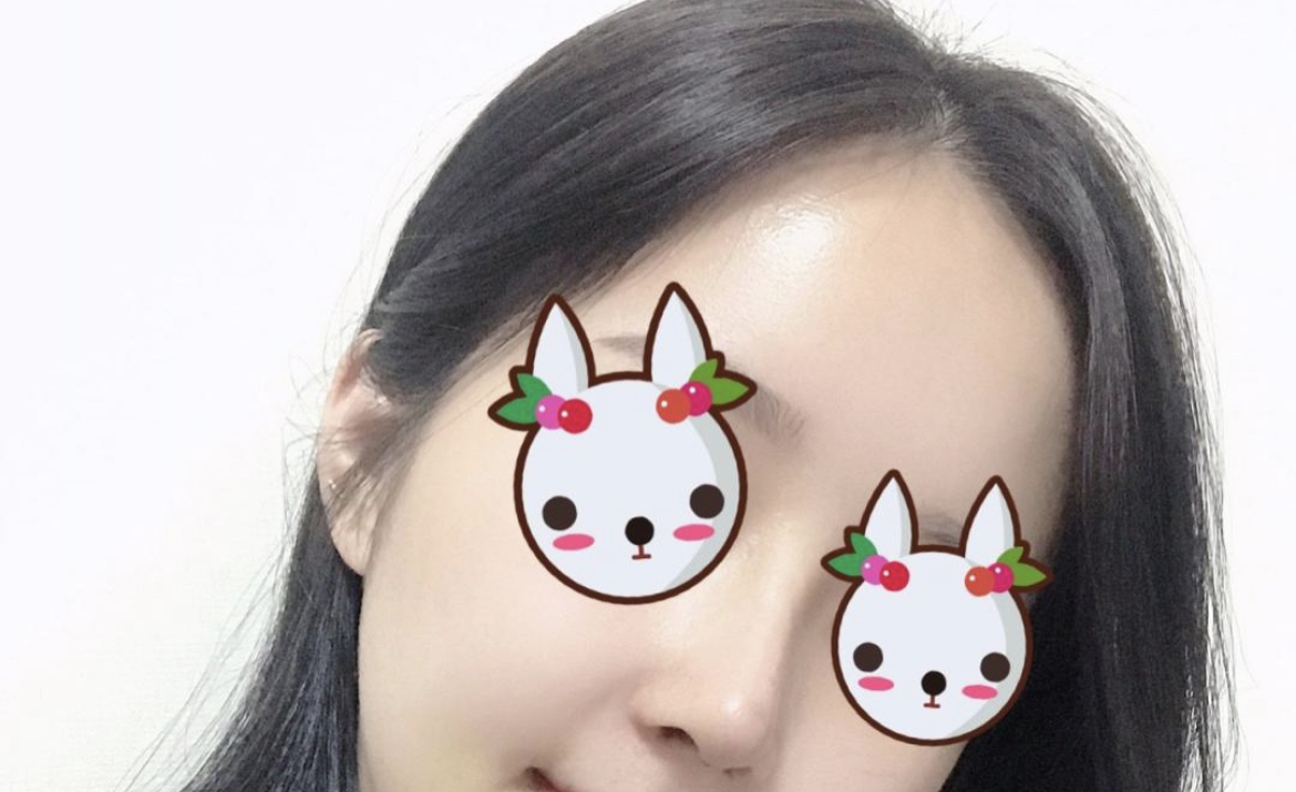 [Mũi] Due View Ing - Mũi