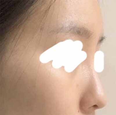 [Mũi] Lu Bing Bbong Bbong - Mũi