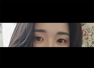 [Mắt] ㅡㅜㅠㅍㅊㅌㅋ - Cắt mí, Mở góc mắt