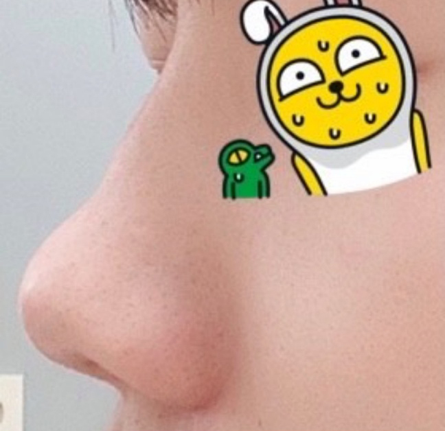 [Mũi] Bichon Shong Shong Shol - Mũi