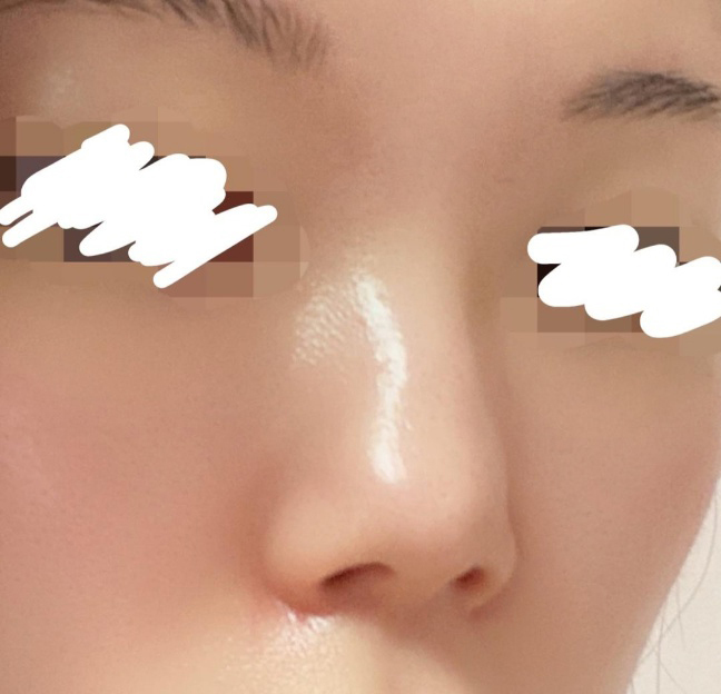 [Mũi] Yomiseu - Mũi