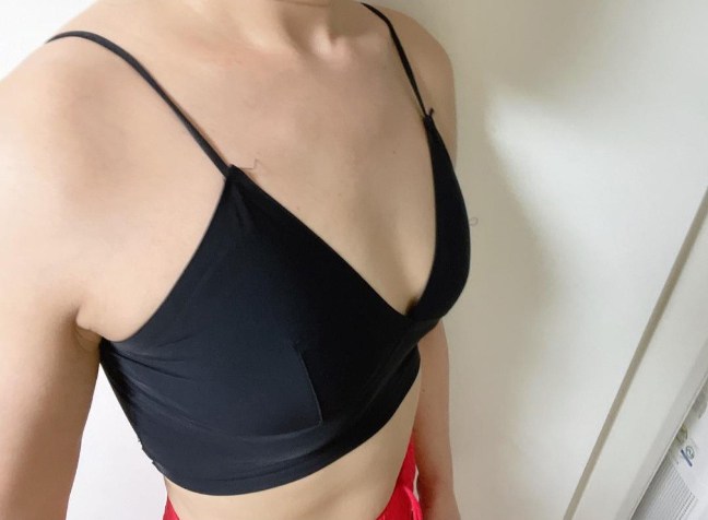 [Ngực] Barbie33 - Ngực (đặt túi)