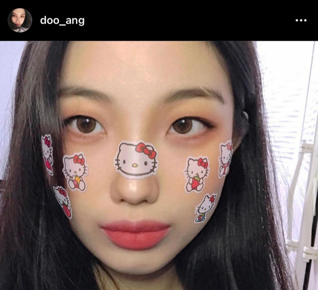 [Mắt] Somhana - Cắt mí, Mở góc mắt trên