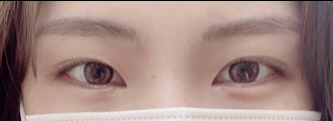 [Mắt] itxufx - Mở góc trên, mở góc dưới