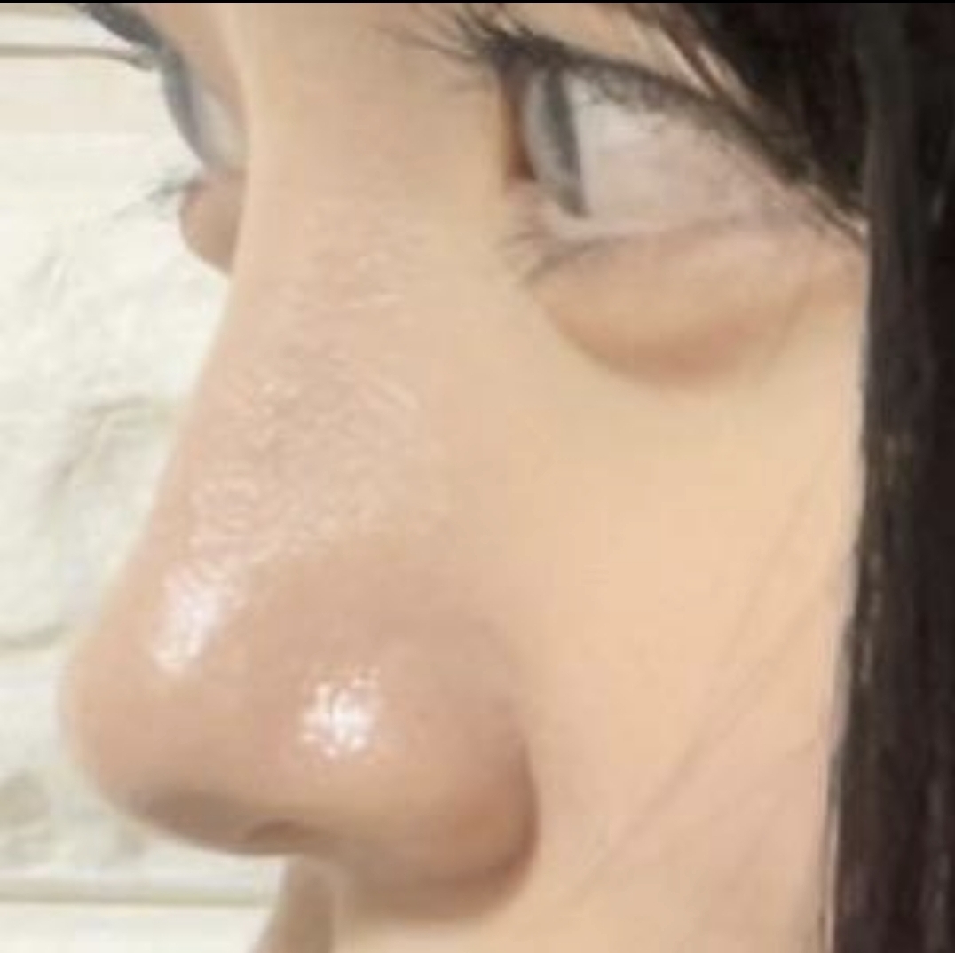 [Mũi] Ttottoi1 - Mũi