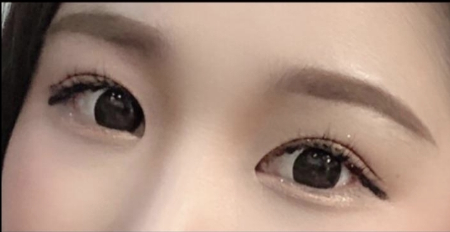 [Mắt] sidhd22 - Mở rộng góc mắt ngoài, hạ góc mắt